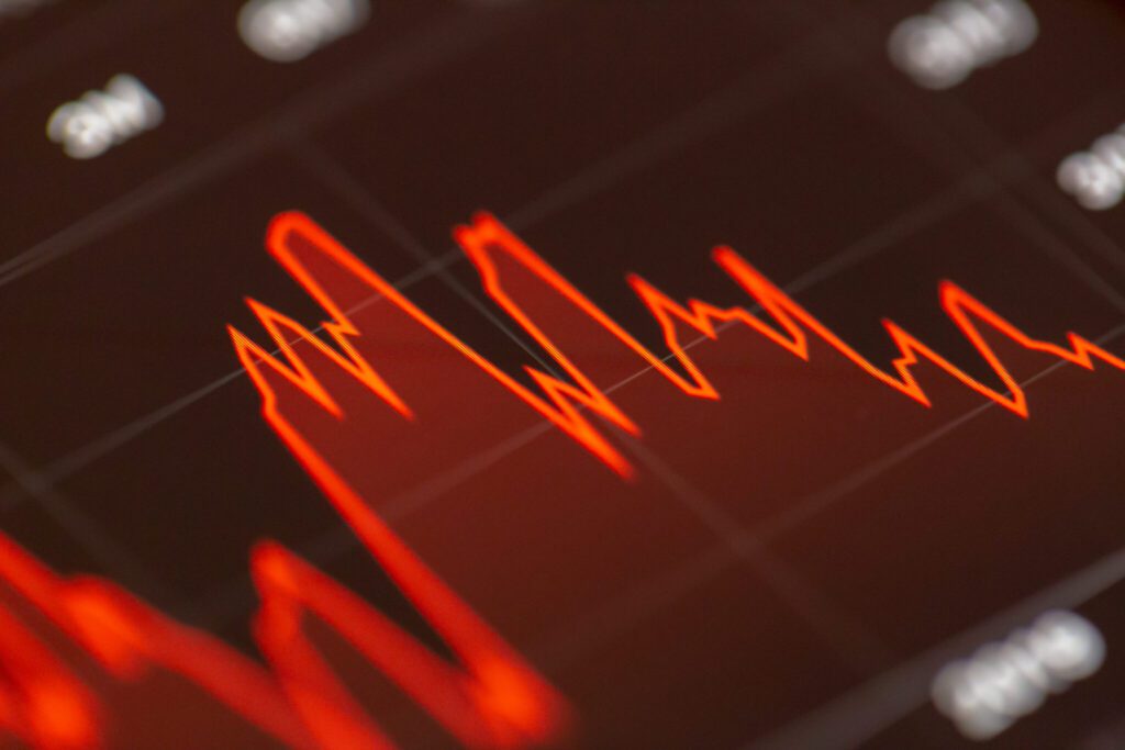 Market Forecast: Stock Market Ends With Minimal Profits - What’s Coming Up on January 24